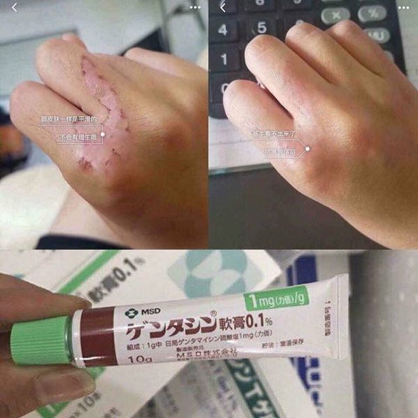 Shop xachtay24h chuyên bán kem trị sẹo Gentacin 10g Nhật